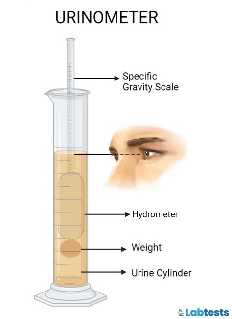 a urinometer or a refractometer is ued to measure the|what is a urinometer.